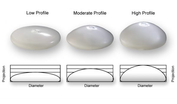 breast implant comparison chart