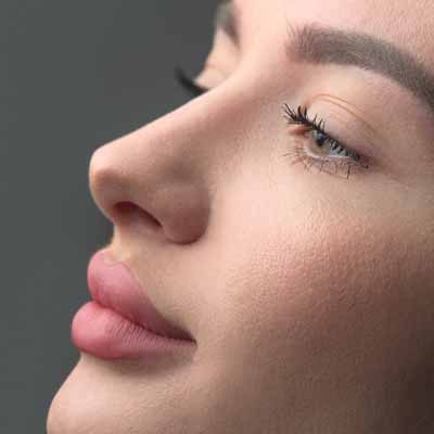 Rhinoplasty
